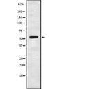Western blot analysis of extracts from Hela cells, using PKM2(phospho-Ser37) Antibody.