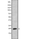 DF7773 at 1/100 staining Rat liver tissue by IHC-P. The sample was formaldehyde fixed and a heat mediated antigen retrieval step in citrate buffer was performed. The sample was then blocked and incubated with the antibody for 1.5 hours at 22¡ãC. An HRP conjugated goat anti-rabbit antibody was used as the secondary
