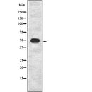 DF7776 at 1/100 staining Rat brain tissue by IHC-P. The sample was formaldehyde fixed and a heat mediated antigen retrieval step in citrate buffer was performed. The sample was then blocked and incubated with the antibody for 1.5 hours at 22¡ãC. An HRP conjugated goat anti-rabbit antibody was used as the secondary