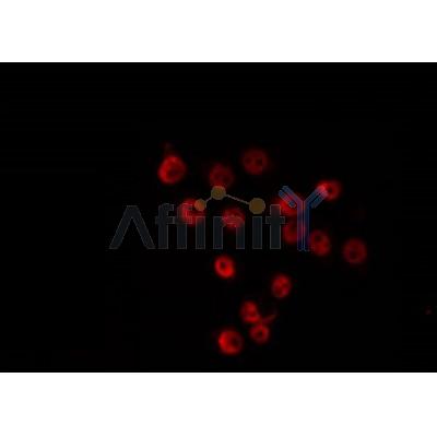 AF0464 staining COS7 by IF/ICC. The sample were fixed with PFA and permeabilized in 0.1% Triton X-100,then blocked in 10% serum for 45 minutes at 25¡ãC. The primary antibody was diluted at 1/200 and incubated with the sample for 1 hour at 37¡ãC. An  Alexa Fluor 594 conjugated goat anti-rabbit IgG (H+L) Ab, diluted at 1/600, was used as the secondary antibod