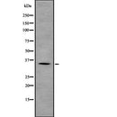 DF7783 at 1/100 staining Human prostate tissue by IHC-P. The sample was formaldehyde fixed and a heat mediated antigen retrieval step in citrate buffer was performed. The sample was then blocked and incubated with the antibody for 1.5 hours at 22¡ãC. An HRP conjugated goat anti-rabbit antibody was used as the secondary