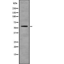 DF7789 at 1/100 staining Rat brain tissue by IHC-P. The sample was formaldehyde fixed and a heat mediated antigen retrieval step in citrate buffer was performed. The sample was then blocked and incubated with the antibody for 1.5 hours at 22¡ãC. An HRP conjugated goat anti-rabbit antibody was used as the secondary