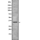 Western blot analysis of HSD17B1 using MCF7 whole  lysates.