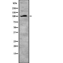 Western blot analysis of DAB2 using Jurkat whole  lysates.