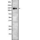 Western blot analysis of SYNJ2 using Jurkat whole  lysates.