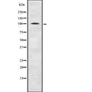 Western blot analysis of GABBR2 using COLO205 whole  lysates.