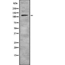 Western blot analysis of PLD1 using COLO205 whole  lysates.