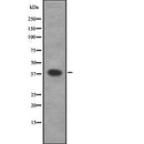 Western blot analysis of CAMK1 using Jurkat whole  lysates.