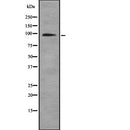 Western blot analysis of HNRNPUL1 using COLO205 whole  lysates.