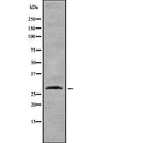 Western blot analysis of TNFRSF4 using Jurkat whole  lysates.