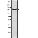 DF7813 at 1/100 staining Mouse spleen tissue by IHC-P. The sample was formaldehyde fixed and a heat mediated antigen retrieval step in citrate buffer was performed. The sample was then blocked and incubated with the antibody for 1.5 hours at 22¡ãC. An HRP conjugated goat anti-rabbit antibody was used as the secondary