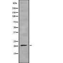 DF7816 at 1/100 staining Human lymph node tissue by IHC-P. The sample was formaldehyde fixed and a heat mediated antigen retrieval step in citrate buffer was performed. The sample was then blocked and incubated with the antibody for 1.5 hours at 22¡ãC. An HRP conjugated goat anti-rabbit antibody was used as the secondary