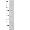 DF7817 at 1/100 staining Mouse lung tissue by IHC-P. The sample was formaldehyde fixed and a heat mediated antigen retrieval step in citrate buffer was performed. The sample was then blocked and incubated with the antibody for 1.5 hours at 22¡ãC. An HRP conjugated goat anti-rabbit antibody was used as the secondary