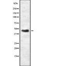 DF7820 staining Hela by IF/ICC. The sample were fixed with PFA and permeabilized in 0.1% Triton X-100,then blocked in 10% serum for 45 minutes at 25¡ãC. The primary antibody was diluted at 1/200 and incubated with the sample for 1 hour at 37¡ãC. An  Alexa Fluor 594 conjugated goat anti-rabbit IgG (H+L) Ab, diluted at 1/600, was used as the secondary antibod