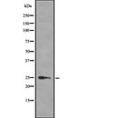 Western blot analysis of HMGB3 using COLO205 whole  lysates.
