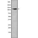 Western blot analysis of REST using COLO205 whole  lysates.