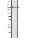 Western blot analysis of NCAM1 using RAW264.7 whole  lysates
