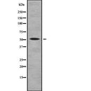 DF7840 staining HuvEC cells by IF/ICC. The sample were fixed with PFA and permeabilized in 0.1% Triton X-100,then blocked in 10% serum for 45 minutes at 25¡ãC. The primary antibody was diluted at 1/200 and incubated with the sample for 1 hour at 37¡ãC. An  Alexa Fluor 594 conjugated goat anti-rabbit IgG (H+L) antibody(Cat.