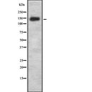 Western blot analysis of SYNGAP1 using HeLa whole  lysates.