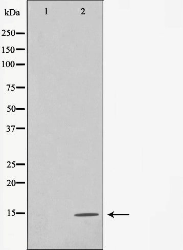 AF0878 staining Hela by IF/ICC. The sample were fixed with PFA and permeabilized in 0.1% Triton X-100,then blocked in 10% serum for 45 minutes at 25¡ãC. The primary antibody was diluted at 1/200 and incubated with the sample for 1 hour at 37¡ãC. An  Alexa Fluor 594 conjugated goat anti-rabbit IgG (H+L) Ab, diluted at 1/600, was used as the secondary antibod