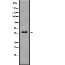 Western blot analysis of TRIB3 using COLO205 whole  lysates.