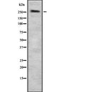 DF7847 staining HeLa cells by IF/ICC. The sample were fixed with PFA and permeabilized in 0.1% Triton X-100,then blocked in 10% serum for 45 minutes at 25¡ãC. The primary antibody was diluted at 1/200 and incubated with the sample for 1 hour at 37¡ãC. An  Alexa Fluor 594 conjugated goat anti-rabbit IgG (H+L) antibody(Cat.
