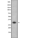 Western blot analysis of extracts from 293, using VTCN1 Antibody. Lane 1 was treated with the antigen-specific peptide.