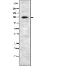Western blot analysis of CUL4B using COLO205 whole  lysates.