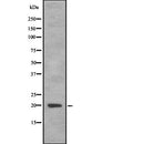 Western blot analysis of AGR2 using HT29 whole  lysates.