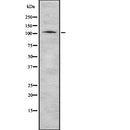 Western blot analysis of FOLH1 using Jurkat whole  lysates.