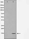 AF0872 staining Hela by IF/ICC. The sample were fixed with PFA and permeabilized in 0.1% Triton X-100,then blocked in 10% serum for 45 minutes at 25¡ãC. The primary antibody was diluted at 1/200 and incubated with the sample for 1 hour at 37¡ãC. An  Alexa Fluor 594 conjugated goat anti-rabbit IgG (H+L) Ab, diluted at 1/600, was used as the secondary antibod