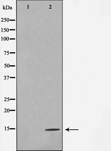 AF0872 staining Hela by IF/ICC. The sample were fixed with PFA and permeabilized in 0.1% Triton X-100,then blocked in 10% serum for 45 minutes at 25¡ãC. The primary antibody was diluted at 1/200 and incubated with the sample for 1 hour at 37¡ãC. An  Alexa Fluor 594 conjugated goat anti-rabbit IgG (H+L) Ab, diluted at 1/600, was used as the secondary antibod