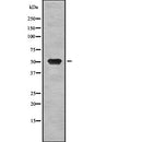 DF7863 staining  HuvEc cells by IF/ICC. The sample were fixed with PFA and permeabilized in 0.1% Triton X-100,then blocked in 10% serum for 45 minutes at 25¡ãC. The primary antibody was diluted at 1/200 and incubated with the sample for 1 hour at 37¡ãC. An  Alexa Fluor 594 conjugated goat anti-rabbit IgG (H+L) antibody(Cat.
