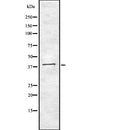 Western blot analysis of MNX1 using LOVO whole  lysates.