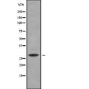 Western blot analysis of HHEX using HeLa whole  lysates.