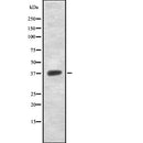 DF7870 at 1/100 staining Human breast cancer tissue by IHC-P. The sample was formaldehyde fixed and a heat mediated antigen retrieval step in citrate buffer was performed. The sample was then blocked and incubated with the antibody for 1.5 hours at 22¡ãC. An HRP conjugated goat anti-rabbit antibody was used as the secondary