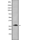DF7871 staining Hela by IF/ICC. The sample were fixed with PFA and permeabilized in 0.1% Triton X-100,then blocked in 10% serum for 45 minutes at 25¡ãC. The primary antibody was diluted at 1/200 and incubated with the sample for 1 hour at 37¡ãC. An  Alexa Fluor 594 conjugated goat anti-rabbit IgG (H+L) Ab, diluted at 1/600, was used as the secondary antibod