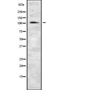 Western blot analysis of INPP4A using HeLa whole  lysates.