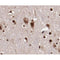 Western blot analysis of p53 using various lysates  Lanes 1 - 2: Merged signal (red and green). Green - AF0879 observed at 53kDa. Red - loading control, T0004, observed at 36 kDa.  Blots were developed with Goat Anti-Rabbit IgG(H+L) FITC–conjugated (S0008) and Goat Anti-Mouse IgG(H+L) Alexa Fluor 594–conjugated  (S0005) secondary antibodies
