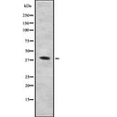 Western blot analysis of PARVA using K562 whole  lysates.