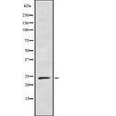 Western blot analysis of BAG2 using Jurkat whole  lysates.
