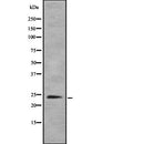 Western blot analysis of TPPP using HeLa whole  lysates.