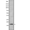 Western blot analysis of AP2S1 using HepG2 whole  lysates.