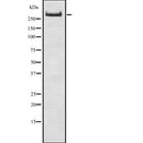 Western blot analysis of TG using K562 whole  lysates.