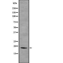 DF7888 at 1/100 staining Mouse liver tissue by IHC-P. The sample was formaldehyde fixed and a heat mediated antigen retrieval step in citrate buffer was performed. The sample was then blocked and incubated with the antibody for 1.5 hours at 22¡ãC. An HRP conjugated goat anti-rabbit antibody was used as the secondary