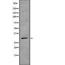 Western blot analysis of SULT1A3 using HuvEc whole  lysates.