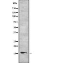 Western blot analysis of LYZ using COLO205 whole  lysates.