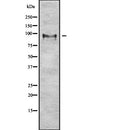 DF7895 at 1/100 staining Human melanoma tissue by IHC-P. The sample was formaldehyde fixed and a heat mediated antigen retrieval step in citrate buffer was performed. The sample was then blocked and incubated with the antibody for 1.5 hours at 22¡ãC. An HRP conjugated goat anti-rabbit antibody was used as the secondary