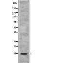 Western blot analysis of SAA4 using HeLa whole  lysates.