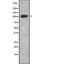 Western blot analysis of PUM2 using Jurkat whole  lysates.